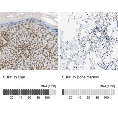 Immunohistochemistry-Paraffin: SUN1 Antibody [NBP1-87396]