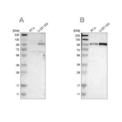 Western Blot: SUN1 Antibody [NBP1-87395]