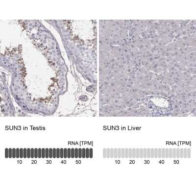 Immunocytochemistry/ Immunofluorescence: SUNC1 Antibody [NBP3-17117]