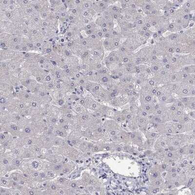 Immunohistochemistry-Paraffin: SUNC1 Antibody [NBP3-17117]