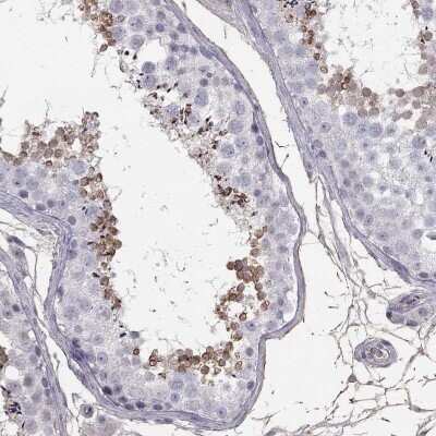 Immunohistochemistry-Paraffin: SUNC1 Antibody [NBP3-17117]