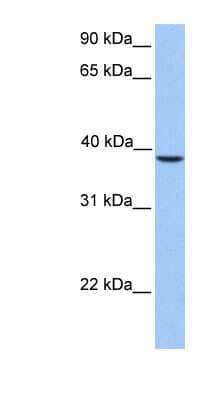 Western Blot: SUNC1 Antibody [NBP1-55413]