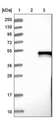 Western Blot: SUNC1 Antibody [NBP1-89567]