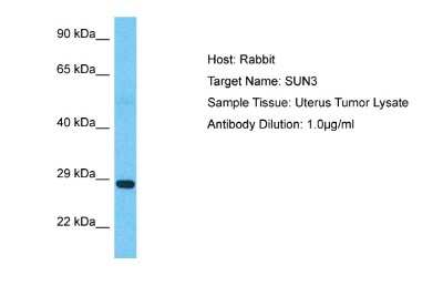 Western Blot: SUNC1 Antibody [NBP2-85843]