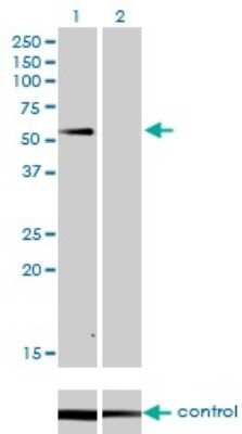 Western Blot: SUOX Antibody (1H1) [H00006821-M01]