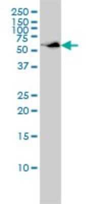 Western Blot: SUOX Antibody (1H1) [H00006821-M01]