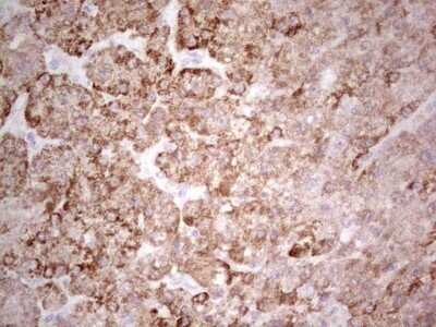 Immunohistochemistry: SUOX Antibody (OTI5A2) - Azide and BSA Free [NBP2-74411]