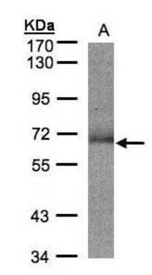Western Blot: SUOX Antibody [NBP1-32423]