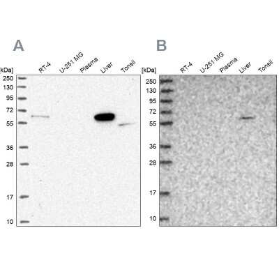 Western Blot: SUOX Antibody [NBP2-38396]