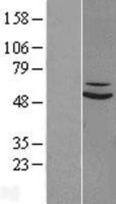 Western Blot: SUOX Overexpression Lysate [NBL1-16615]