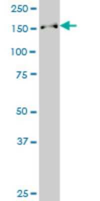 Western Blot: SUPT16H Antibody (1D12) [H00011198-M01]