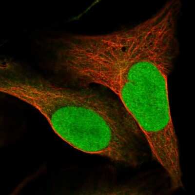 Immunocytochemistry/ Immunofluorescence: SUPT16H Antibody [NBP2-38607]