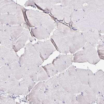 Immunohistochemistry-Paraffin: SUPT16H Antibody [NBP2-38607]