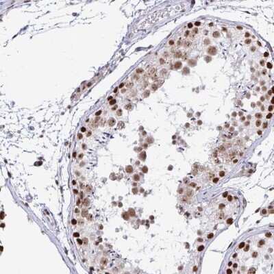 Immunohistochemistry-Paraffin: SUPT16H Antibody [NBP2-38607]