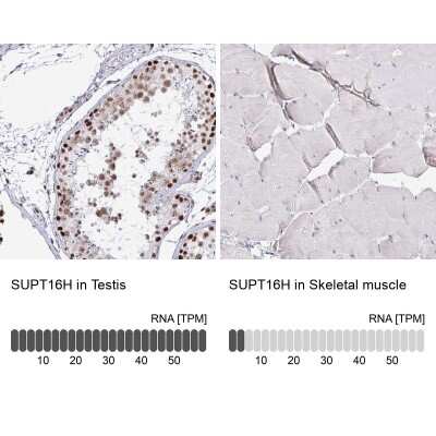 Immunohistochemistry-Paraffin: SUPT16H Antibody [NBP2-38607]