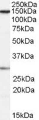 Western Blot: SUPT16H Antibody [NB100-60942]