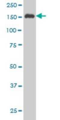 Western Blot: SUPT5H Antibody (3B1) [H00006829-M03]