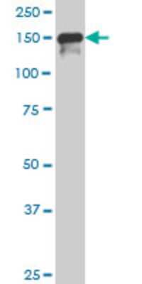 Western Blot: SUPT5H Antibody (3F1) [H00006829-M01]