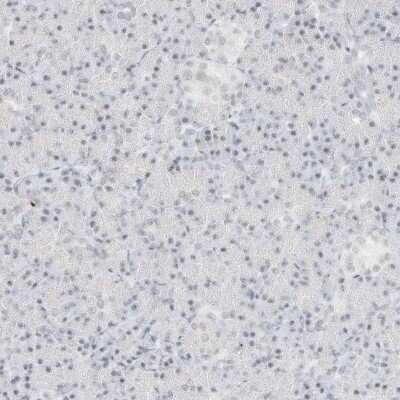 Immunohistochemistry-Paraffin: SUPT5H Antibody [NBP1-83508]