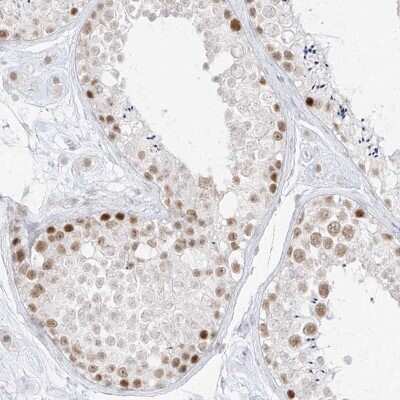 Immunohistochemistry-Paraffin: SUPT5H Antibody [NBP1-83508]