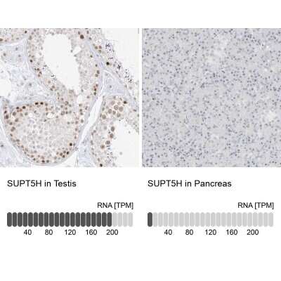 Immunohistochemistry-Paraffin: SUPT5H Antibody [NBP1-83508]