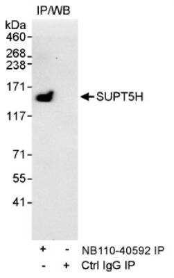 Immunoprecipitation: SUPT5H Antibody [NB110-40592]