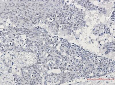 Immunohistochemistry-Paraffin: SUPT5H Antibody (S01-5C2) [NBP3-20004]