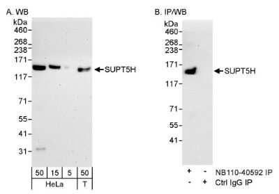 Western Blot: SUPT5H Antibody [NB110-40593]