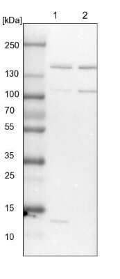 Western Blot: SUPT5H Antibody [NBP1-83508]