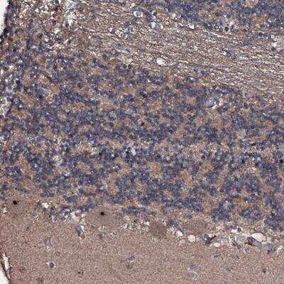 Immunohistochemistry: SUPT7L Antibody [NBP1-93722]