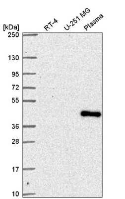 Western Blot: SUPT7L Antibody [NBP2-57671]