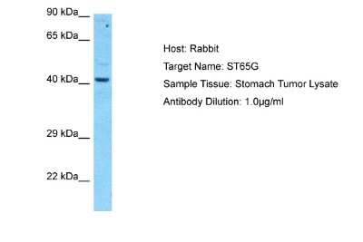 Western Blot: SUPT7L Antibody [NBP2-85846]