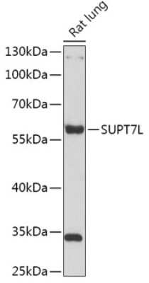 Western Blot: SUPT7L AntibodyAzide and BSA Free [NBP2-93096]