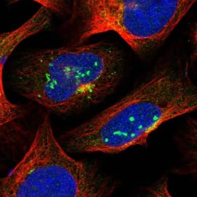 Immunocytochemistry/ Immunofluorescence: SUR1 Antibody [NBP2-34077]