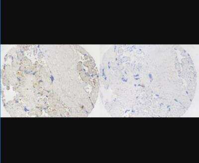 Immunohistochemistry: SUR1 Antibody [NBP2-34077]