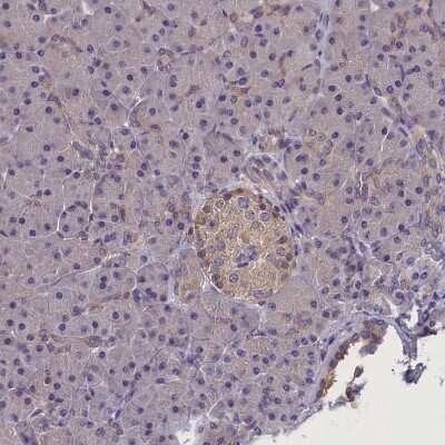 Immunohistochemistry-Paraffin: SUR1 Antibody [NBP2-34077]