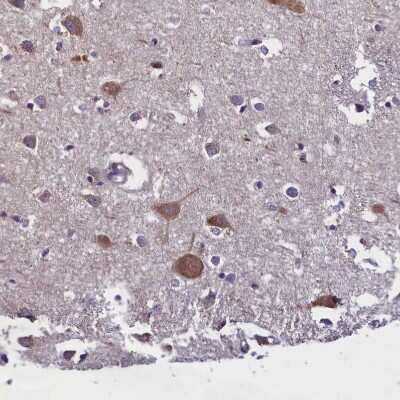 Immunohistochemistry-Paraffin: SUR1 Antibody [NBP2-34077]