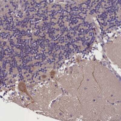 Immunohistochemistry-Paraffin: SUR1 Antibody [NBP2-34077]