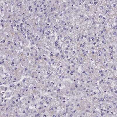 Immunohistochemistry-Paraffin: SUR1 Antibody [NBP2-34077]