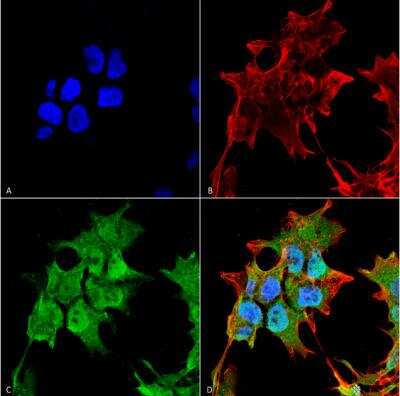 Immunocytochemistry/ Immunofluorescence: SUR1 Antibody (S289-16) [NBP2-59320]