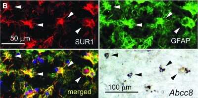 Immunocytochemistry/ Immunofluorescence: SUR1 Antibody (S289-16) [NBP2-59320]