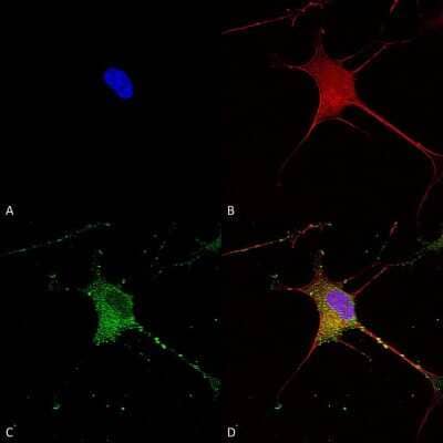 Immunocytochemistry/ Immunofluorescence: SUR1 Antibody (S289-16) [NBP2-59320]