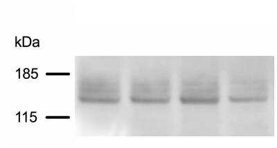 Western Blot: SUR1 Antibody (S289-16) [NBP2-59320]