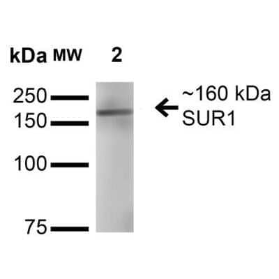 Western Blot: SUR1 Antibody (S289-16) [NBP2-59320]