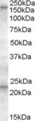 Western Blot: SUR1 Antibody [NBP1-00138]