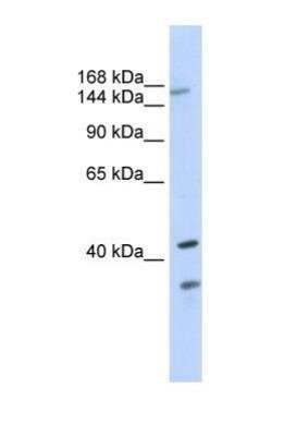 Western Blot: SUR1 Antibody [NBP1-59778]