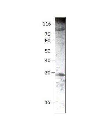 Western Blot: SUR1 Antibody [NBP3-12497]