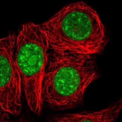 Immunocytochemistry/ Immunofluorescence: SURF2 Antibody [NBP2-56730]