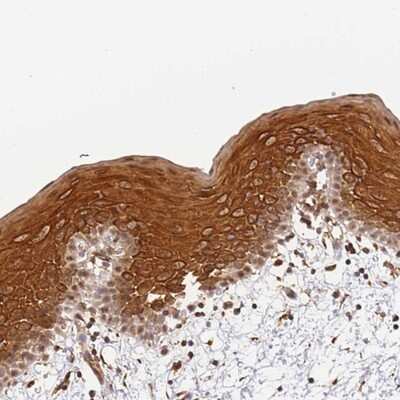 Immunohistochemistry-Paraffin: SURF2 Antibody [NBP2-13400]