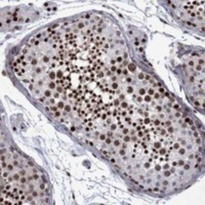 Immunohistochemistry-Paraffin: SURF2 Antibody [NBP3-17544]